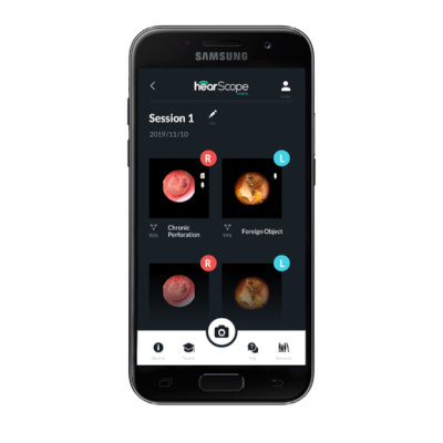 WORLD’S FIRST OTOSCOPE WITH ARTIFICIAL INTELLIGENCE (AI) IMAGE CLASSIFICATION OF EAR DISEASES